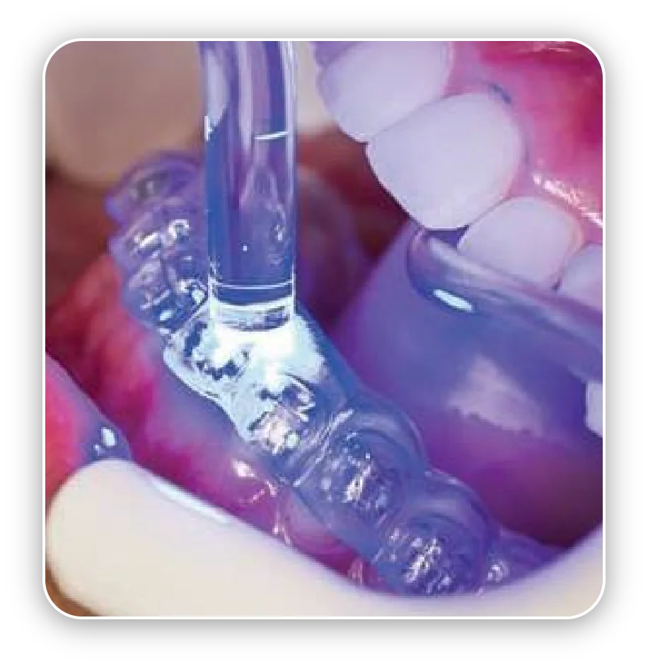 Services Arcad Digital Orthodontics