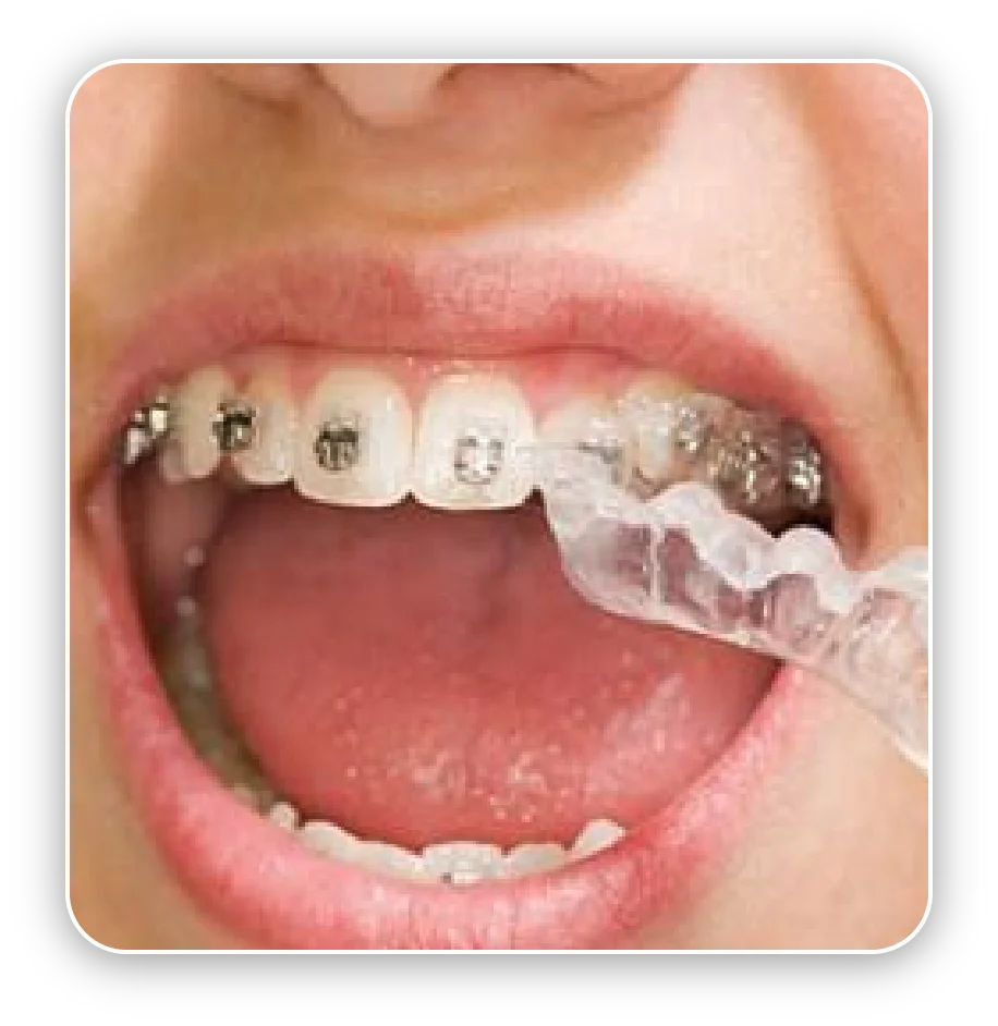 Services Arcad Digital Orthodontics